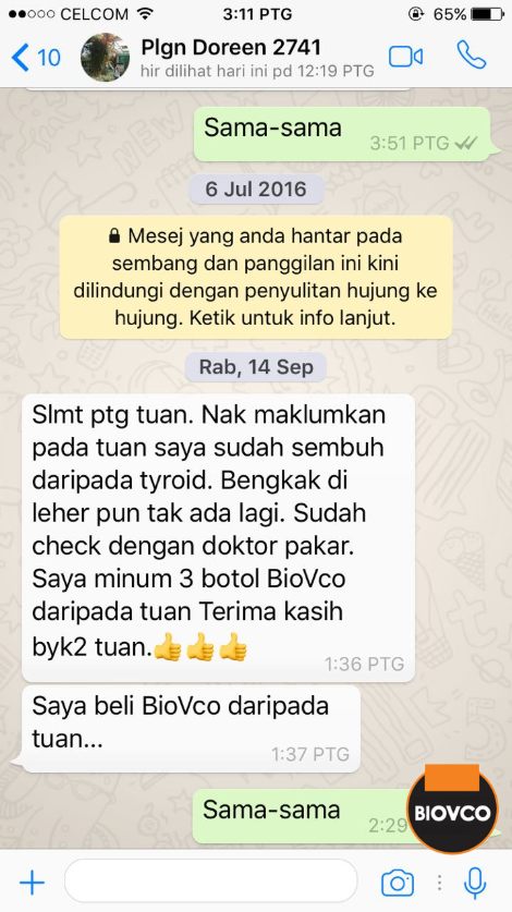 Kelenjar tiroid merupakan sejenis kelenjar endokrin yang terletak di bahagian hadapan leher anda