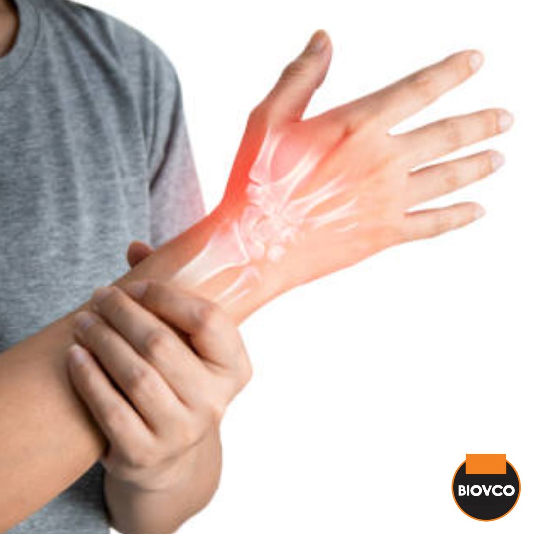 Rawatan psoriasis boleh membantu mengurangkan risiko arthritis psoriatik.